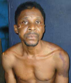 Benjamin Ndubuisi  appears to have been beaten in this photo