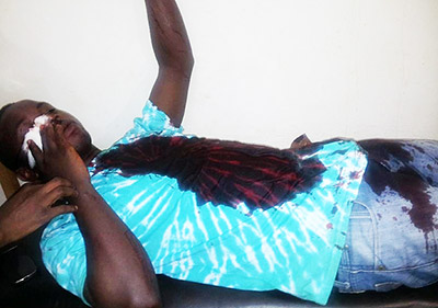 ugandan_activist_attacked_by_mob_intensive_care