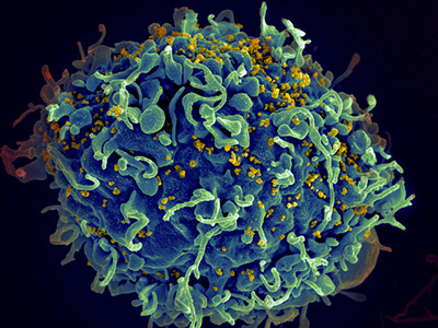 HIV particles infecting a human T cell (Image: NIH)