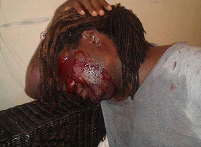 Malawi-man-beaten-in-bloody-anti-gay-attack