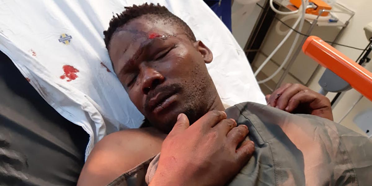 Sisonke Yafele was the victim of suspected hate crime